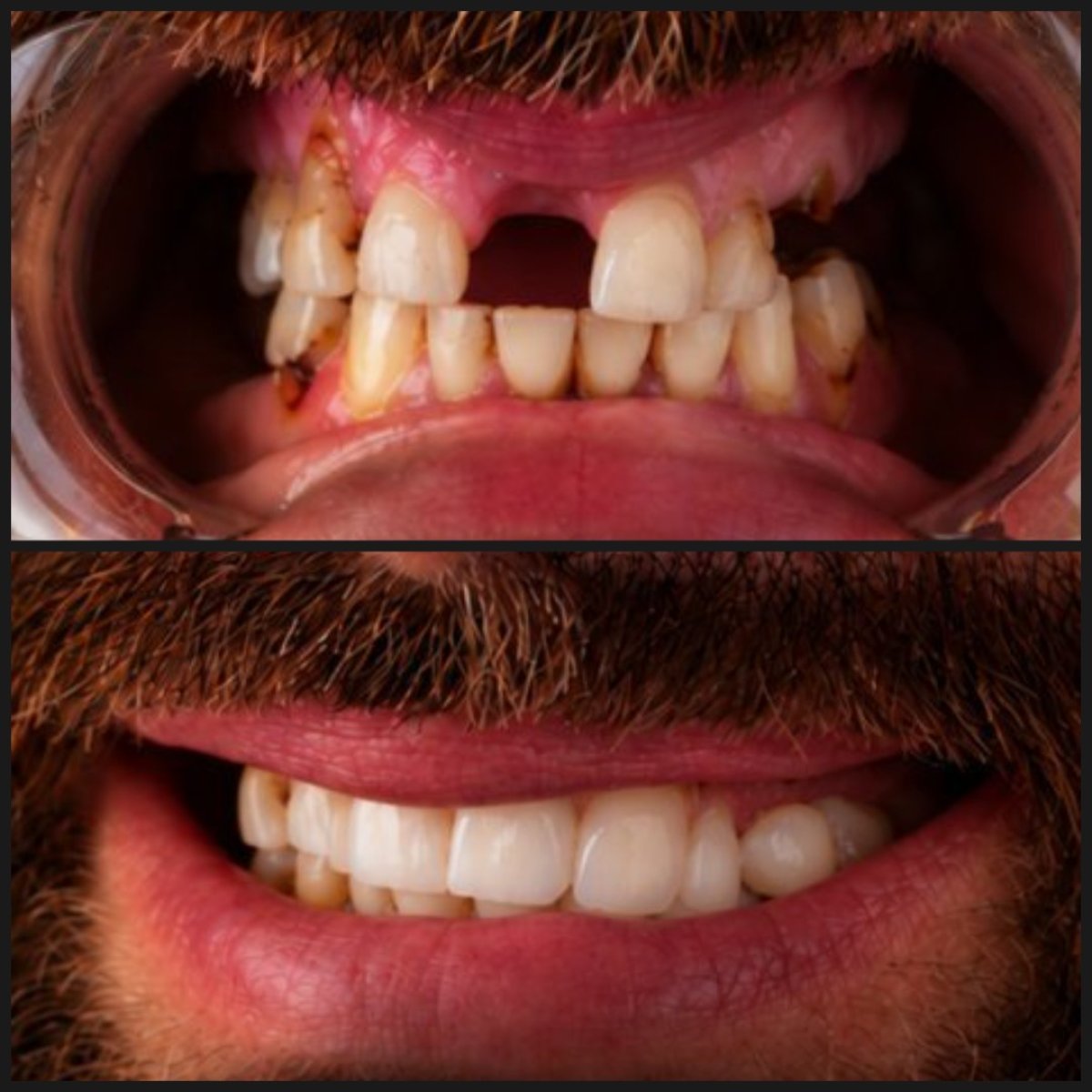 before and after photo