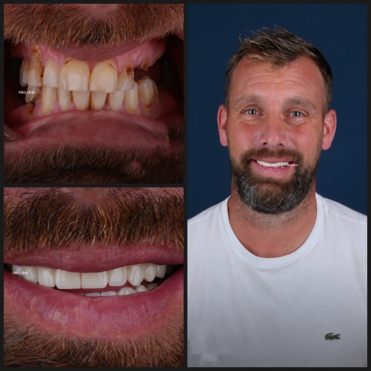 before and after photo