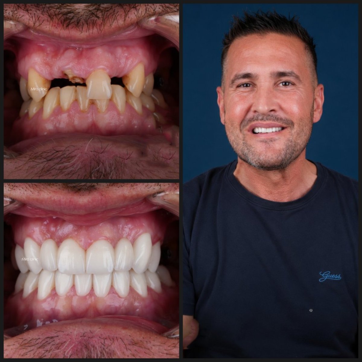 before and after photo