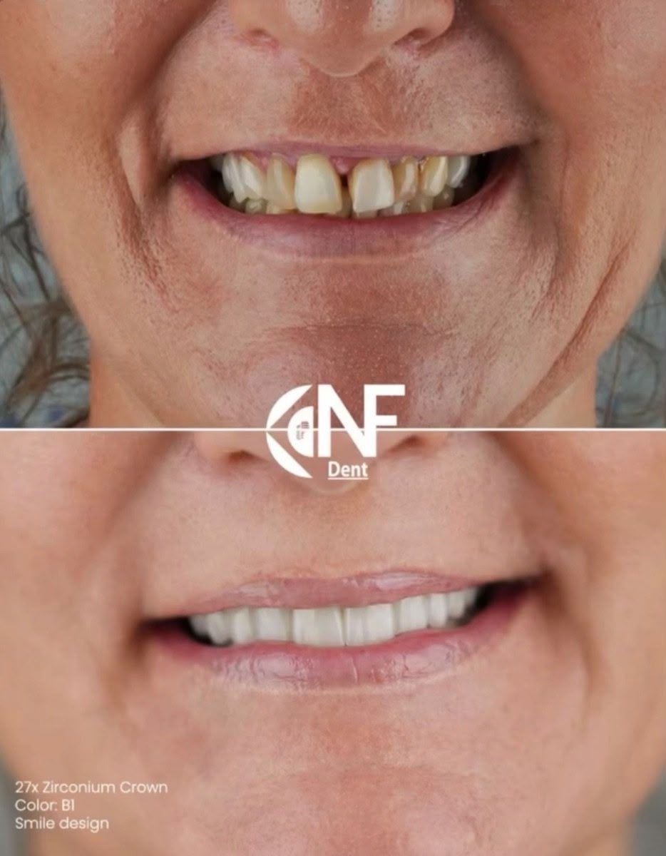 before and after photo