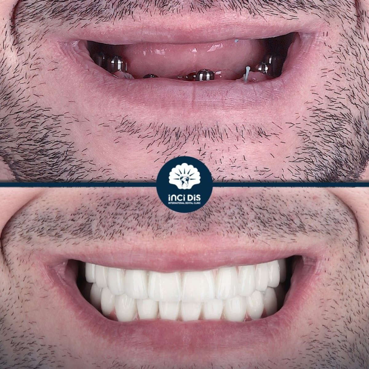 before and after photo