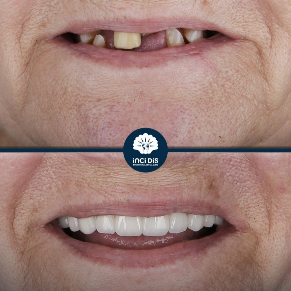 before and after photo