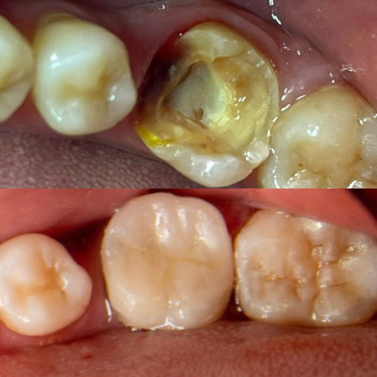 before and after photo