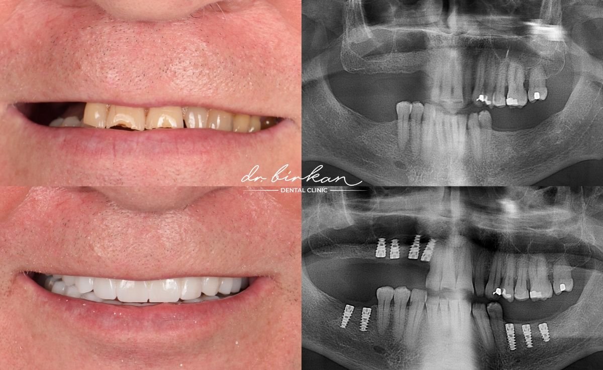 before and after photo