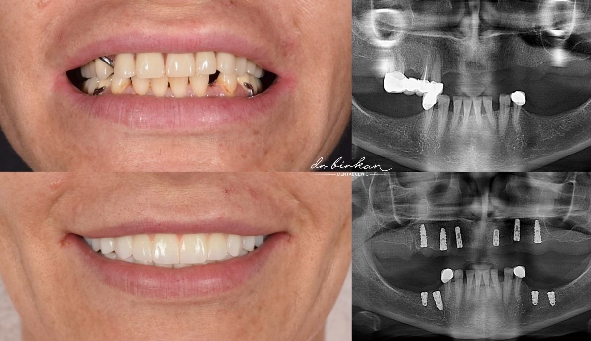 before and after photo