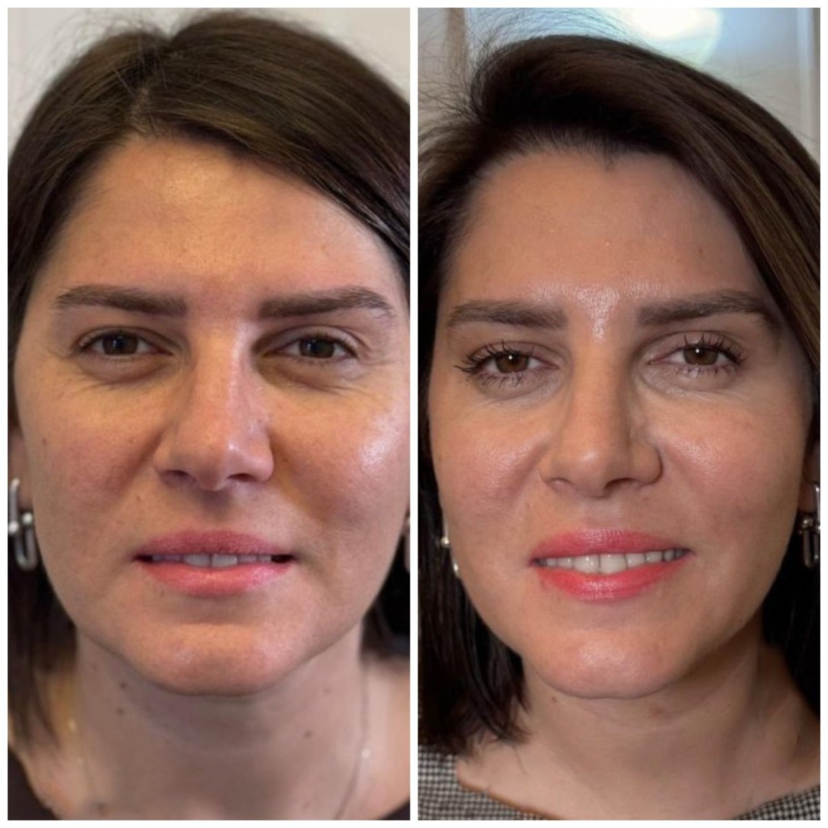 before and after photo