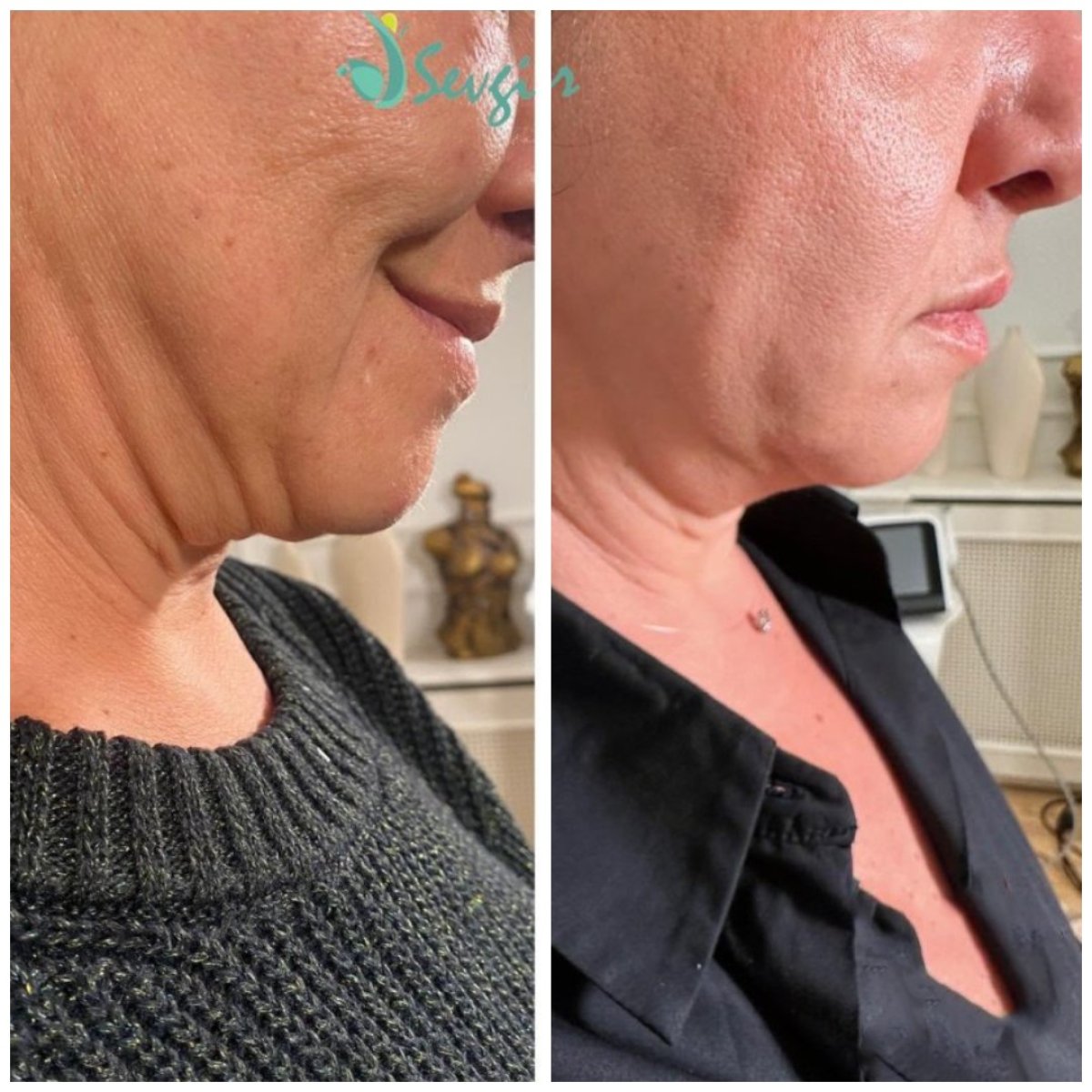 before and after photo