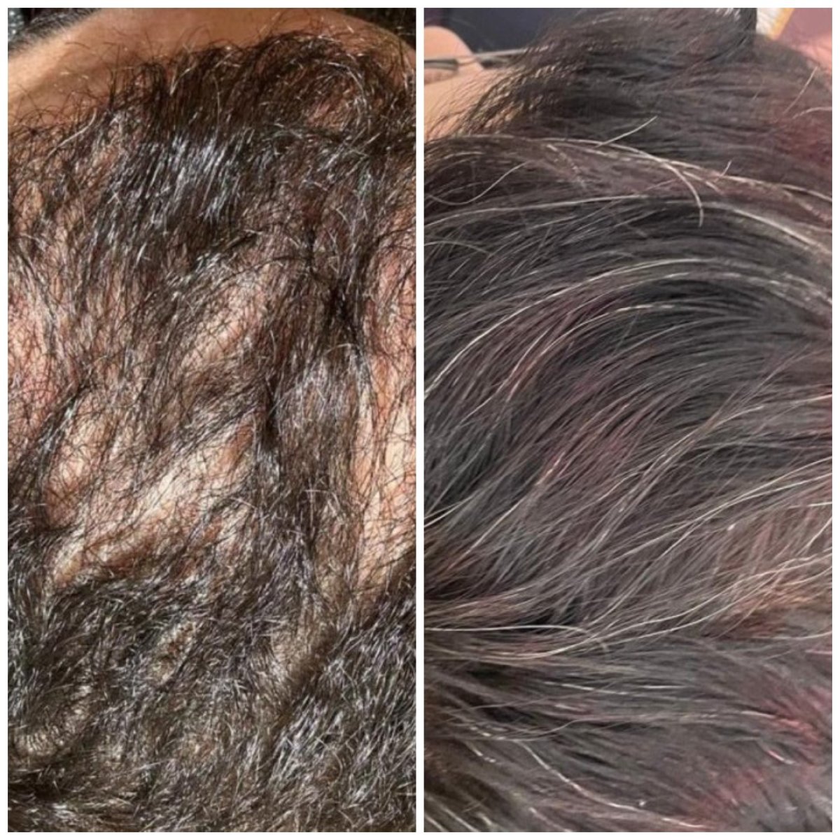 before and after photo