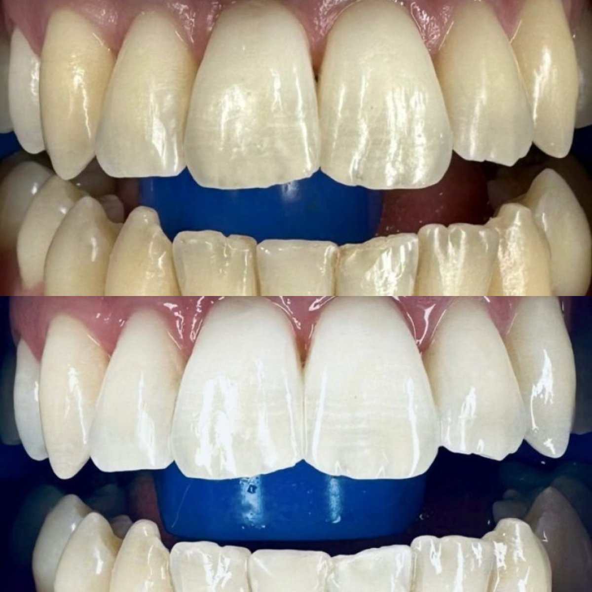 before and after photo