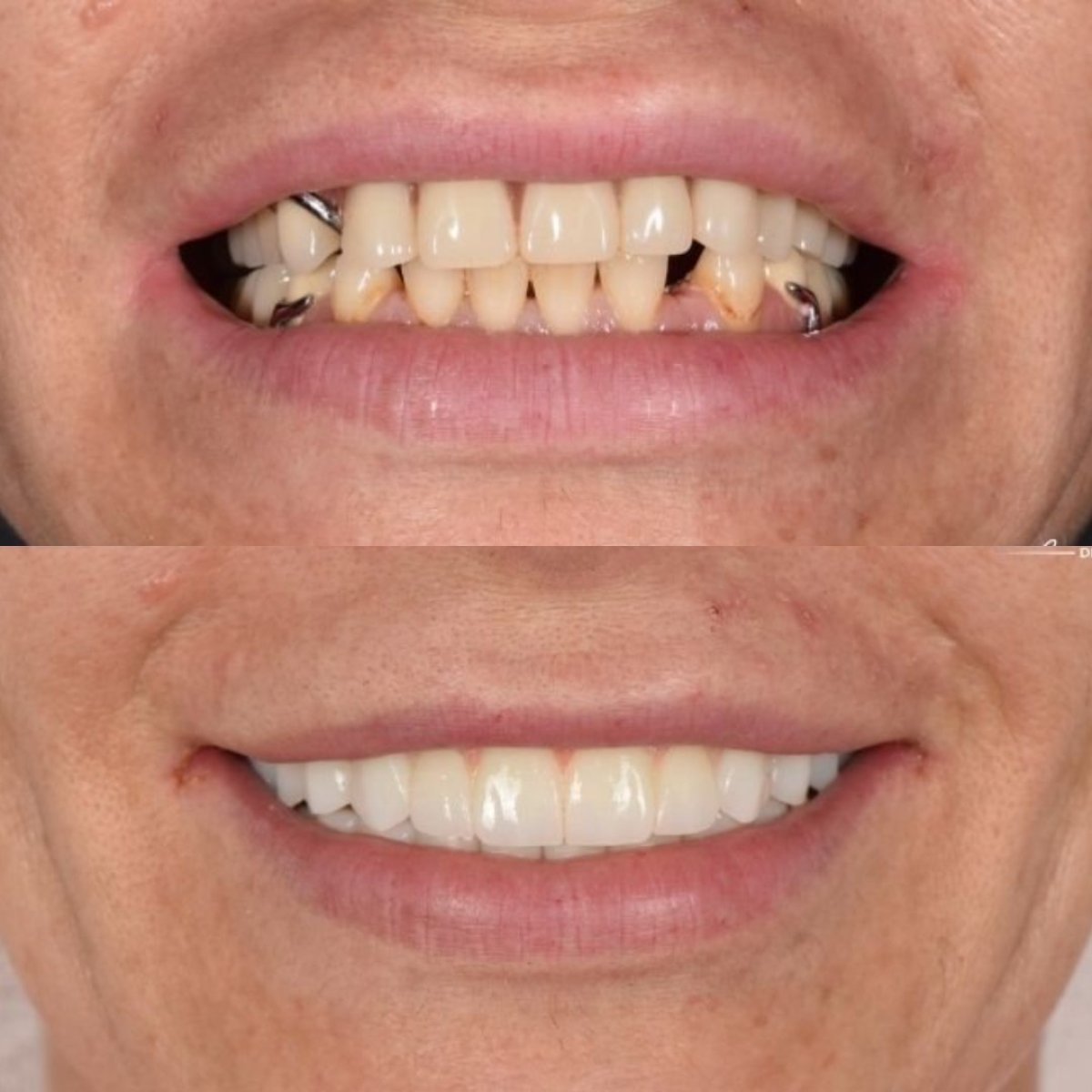 before and after photo