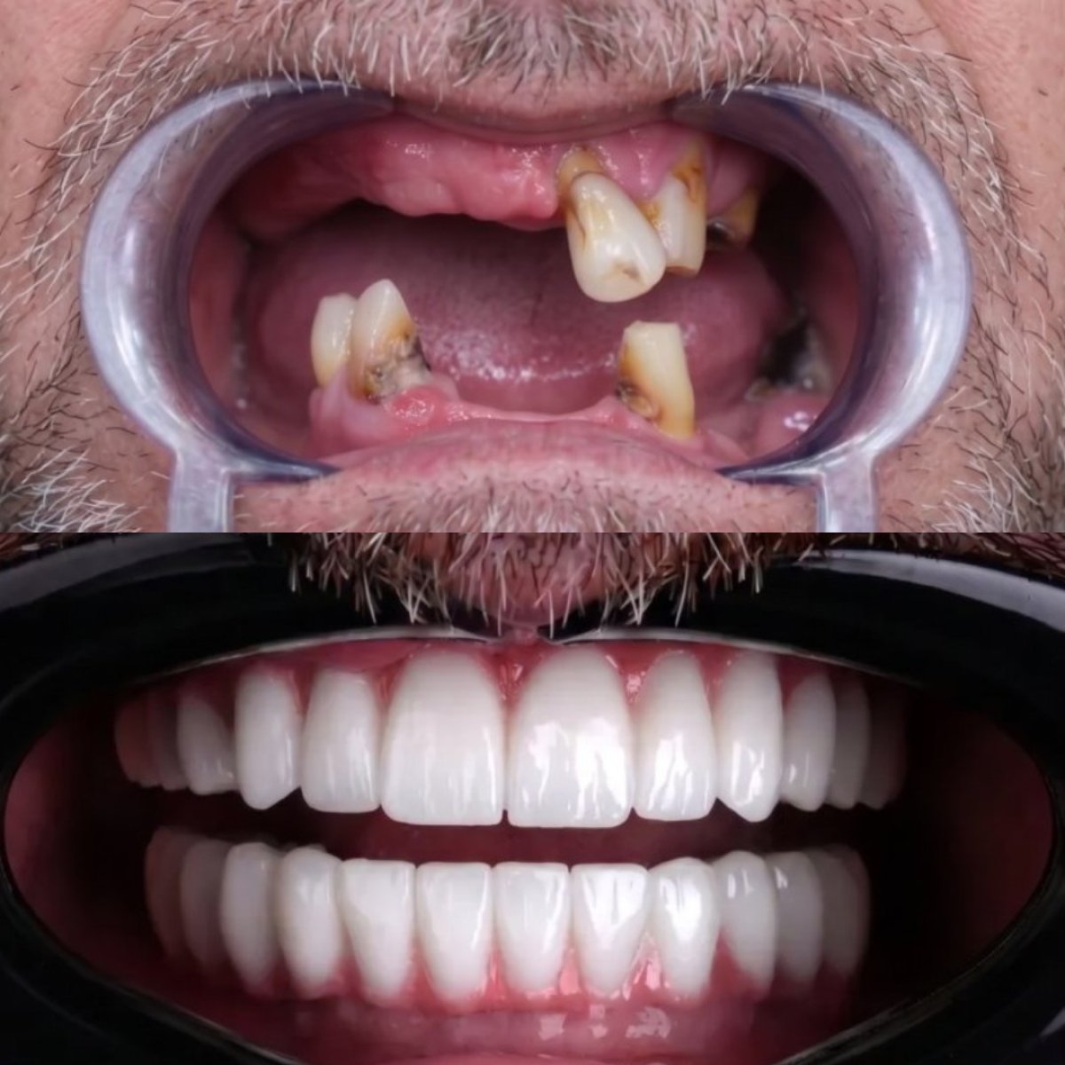 before and after photo
