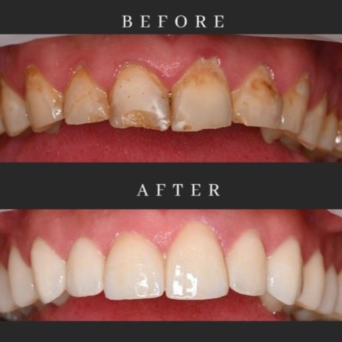 before and after photo