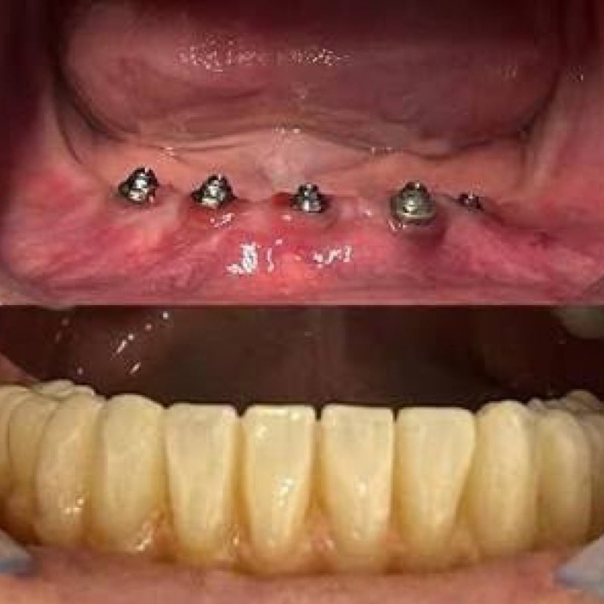 before and after photo