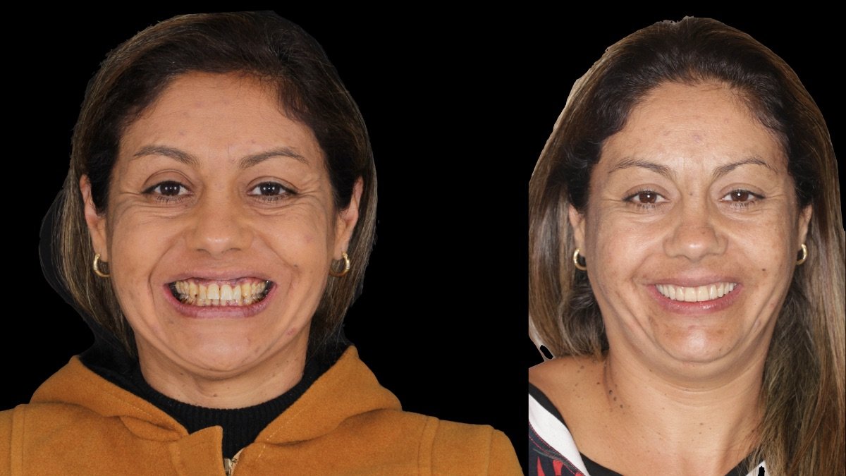 before and after photo