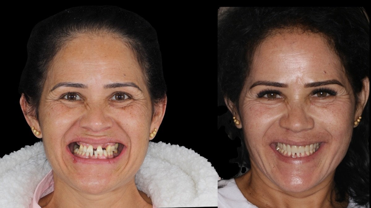 before and after photo