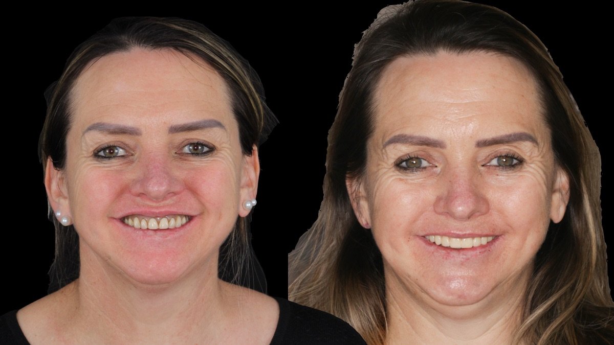 before and after photo