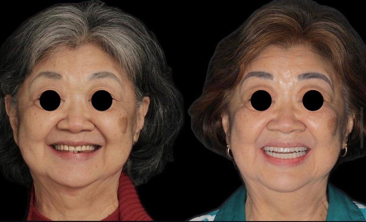 before and after photo