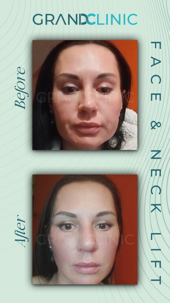 before and after photo