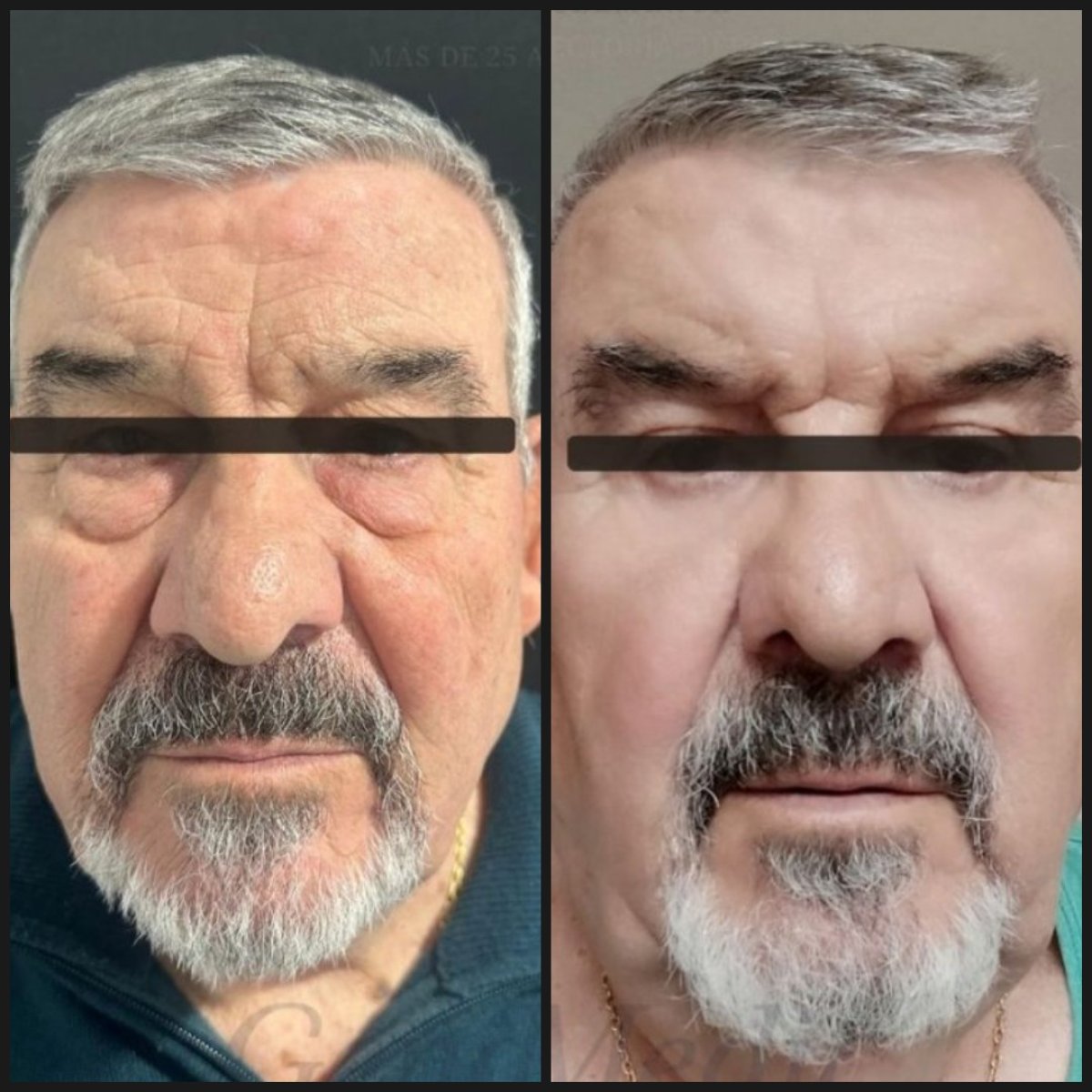 before and after photo