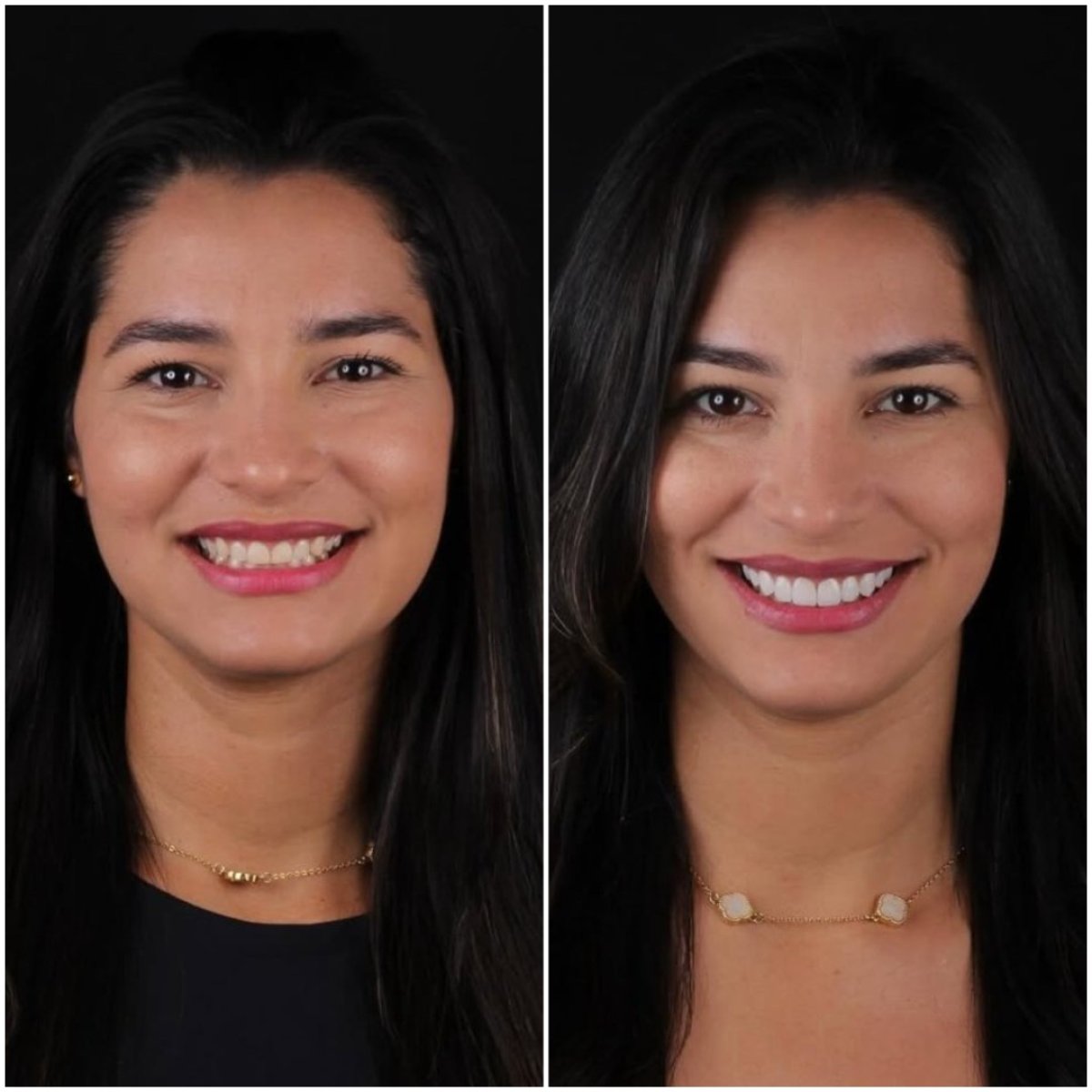 before and after photo