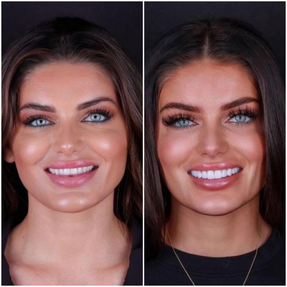 before and after photo