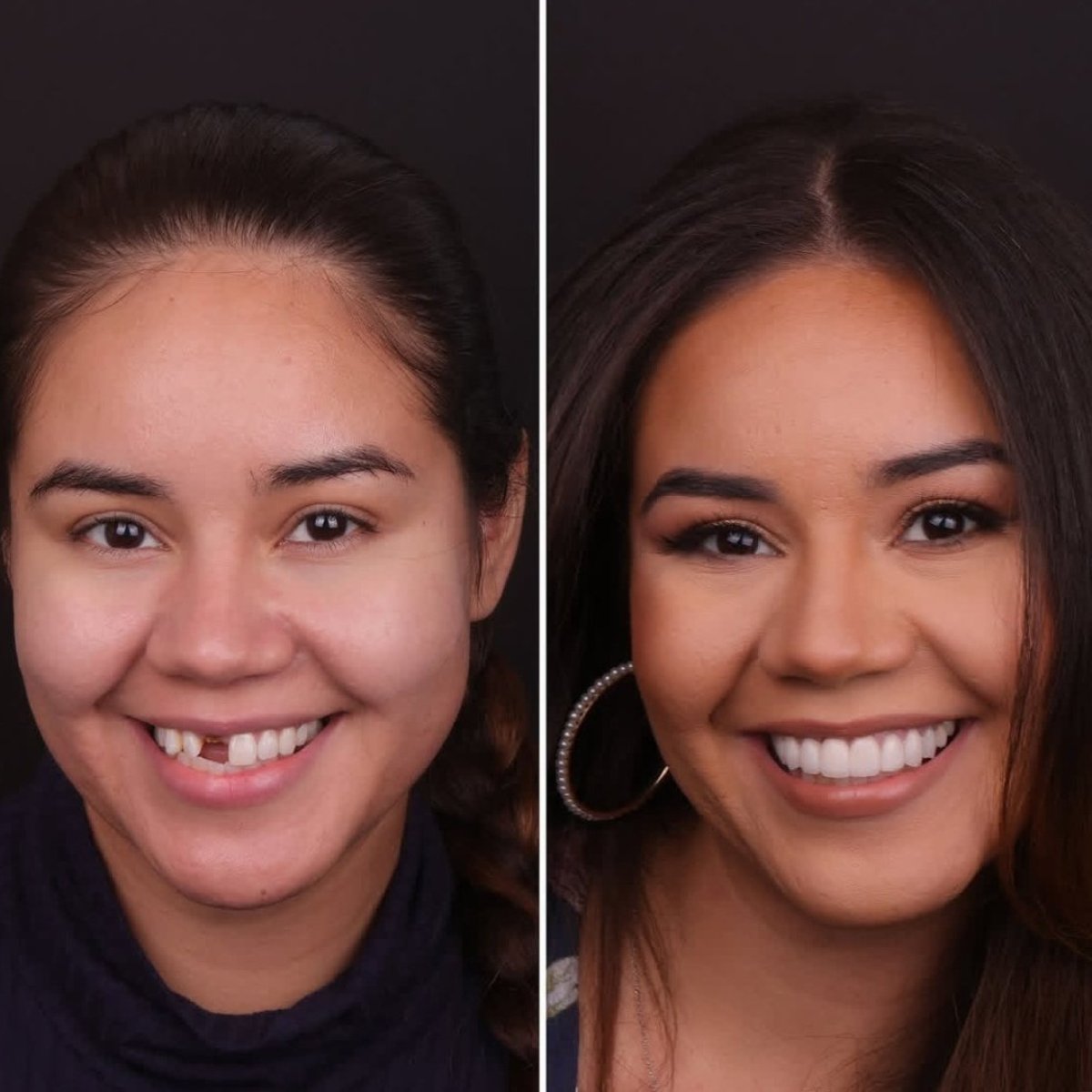 before and after photo