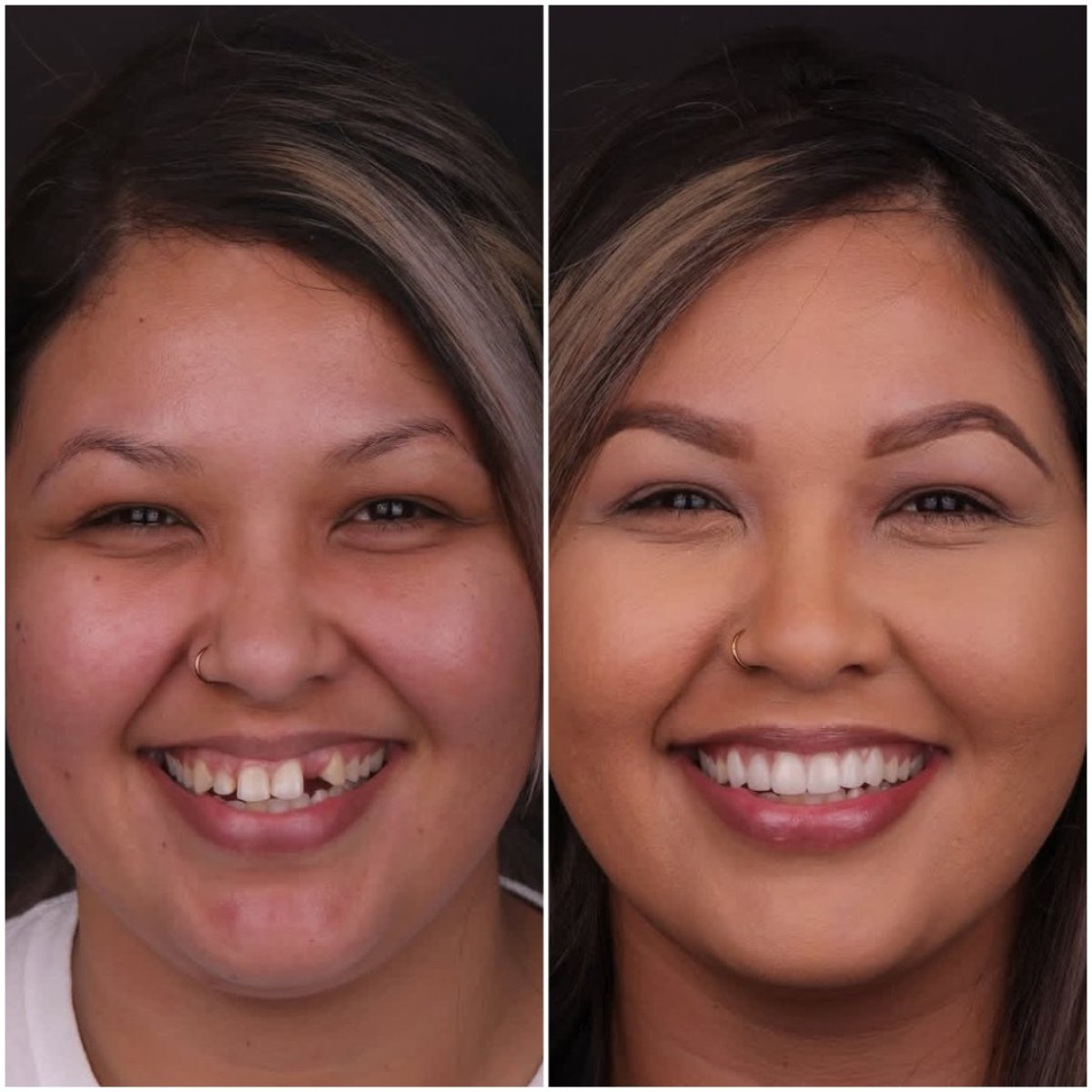 before and after photo