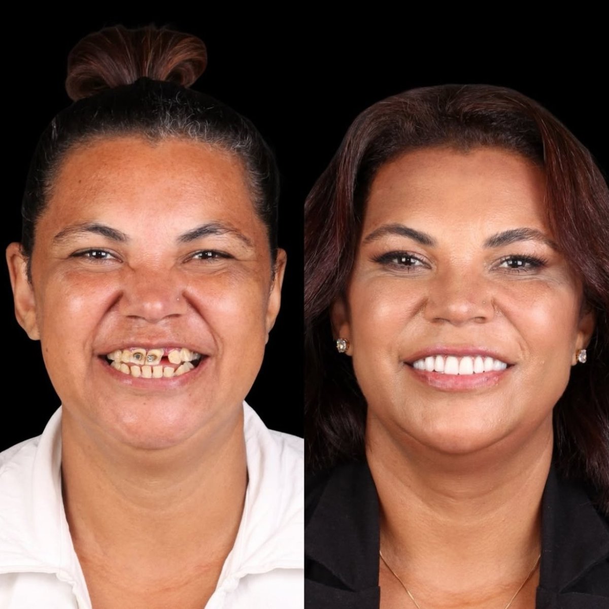 before and after photo