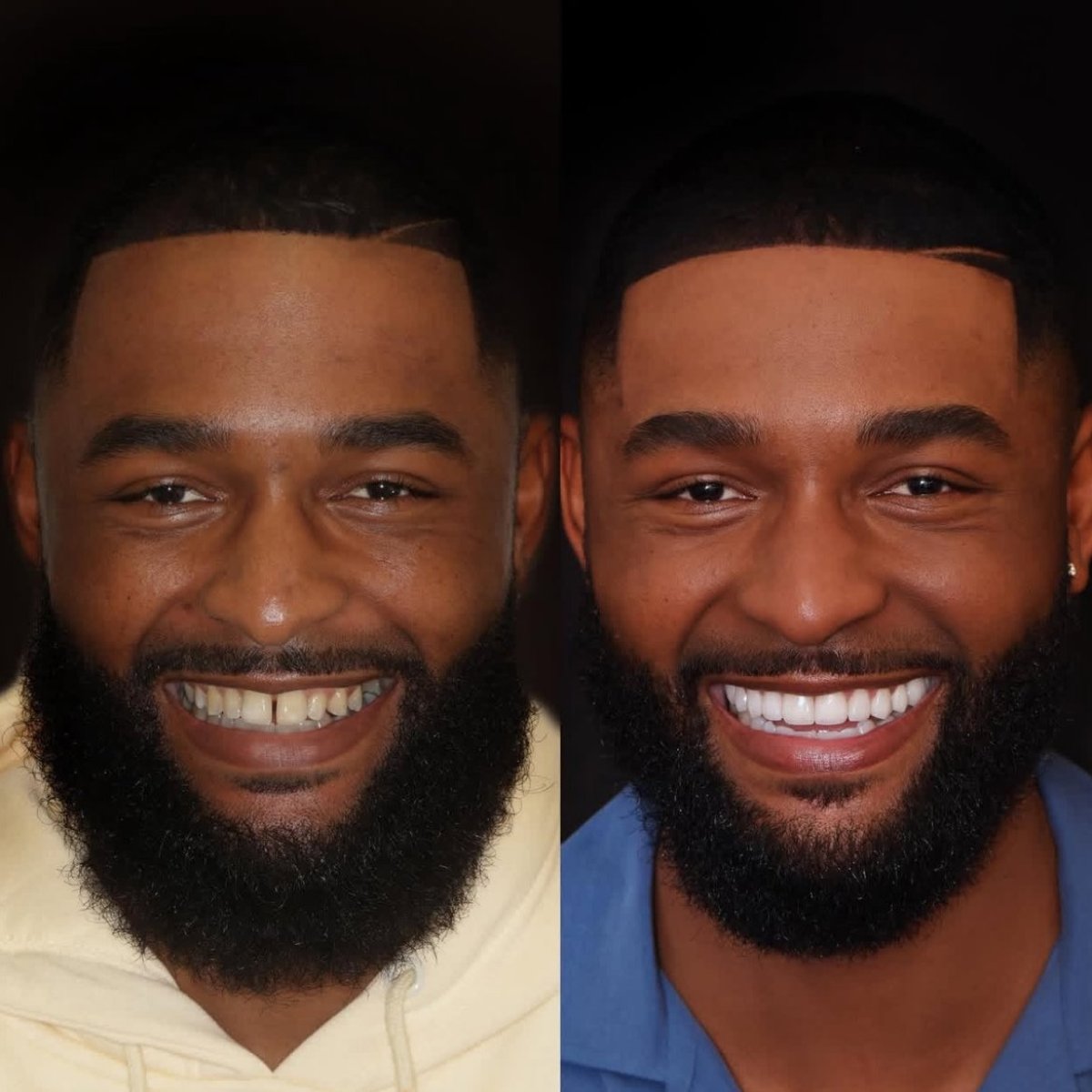 before and after photo