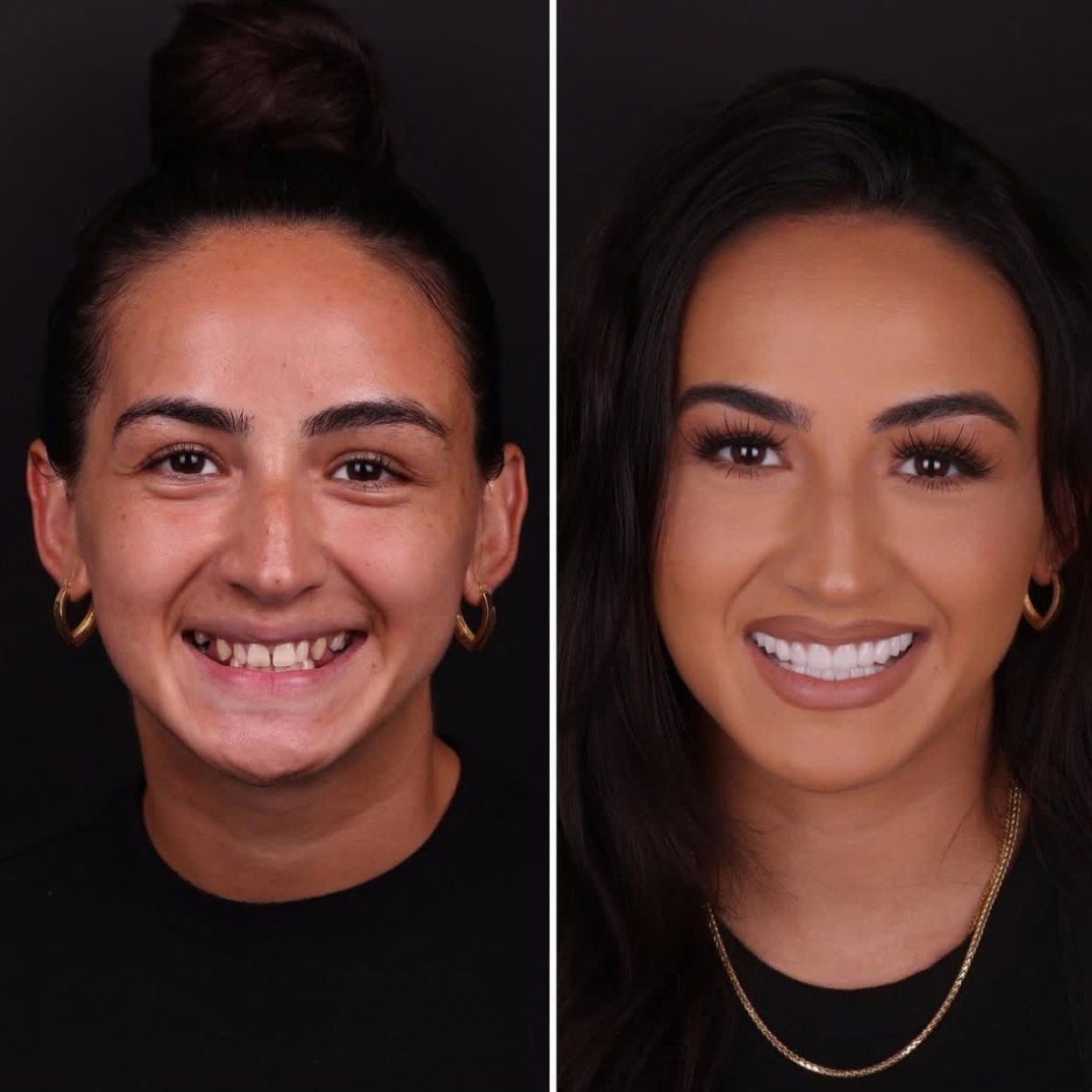 before and after photo