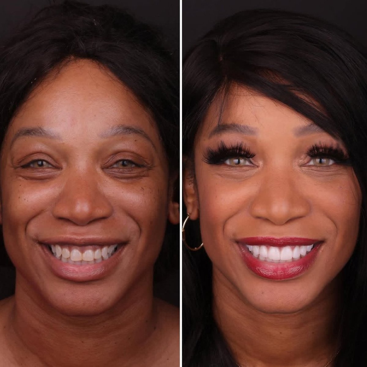 before and after photo