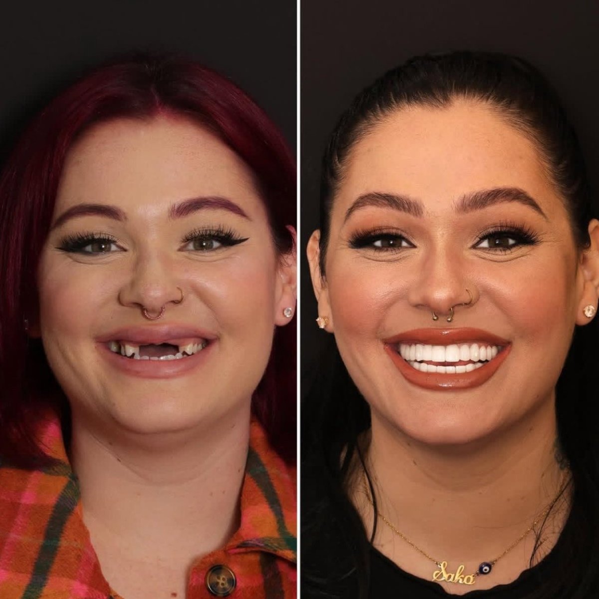 before and after photo