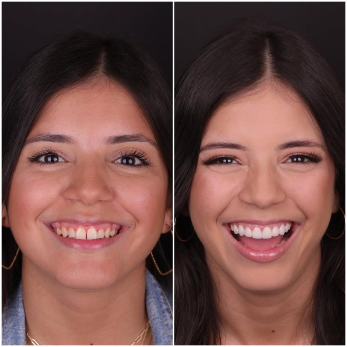before and after photo