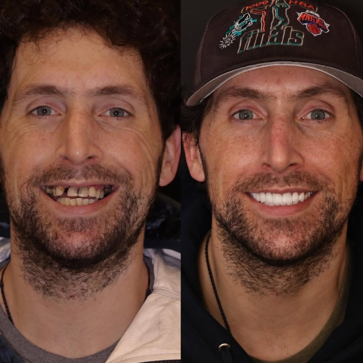 before and after photo