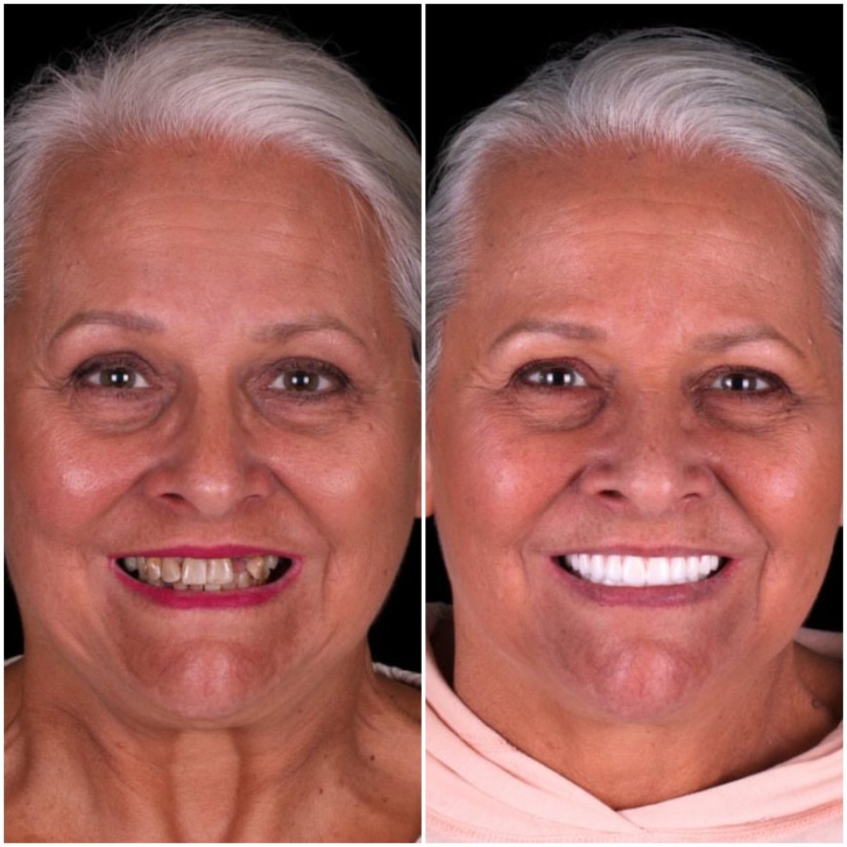 before and after photo