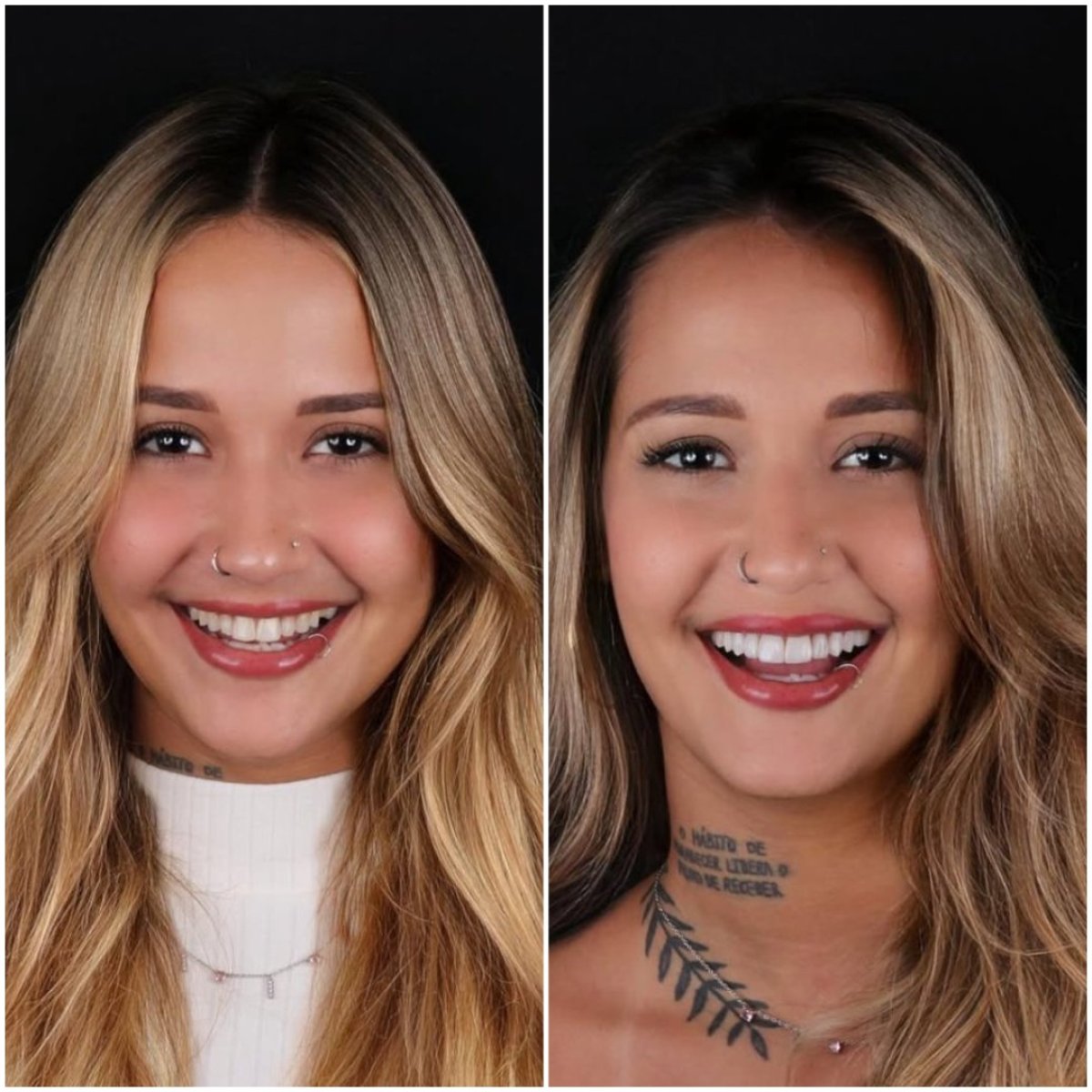 before and after photo