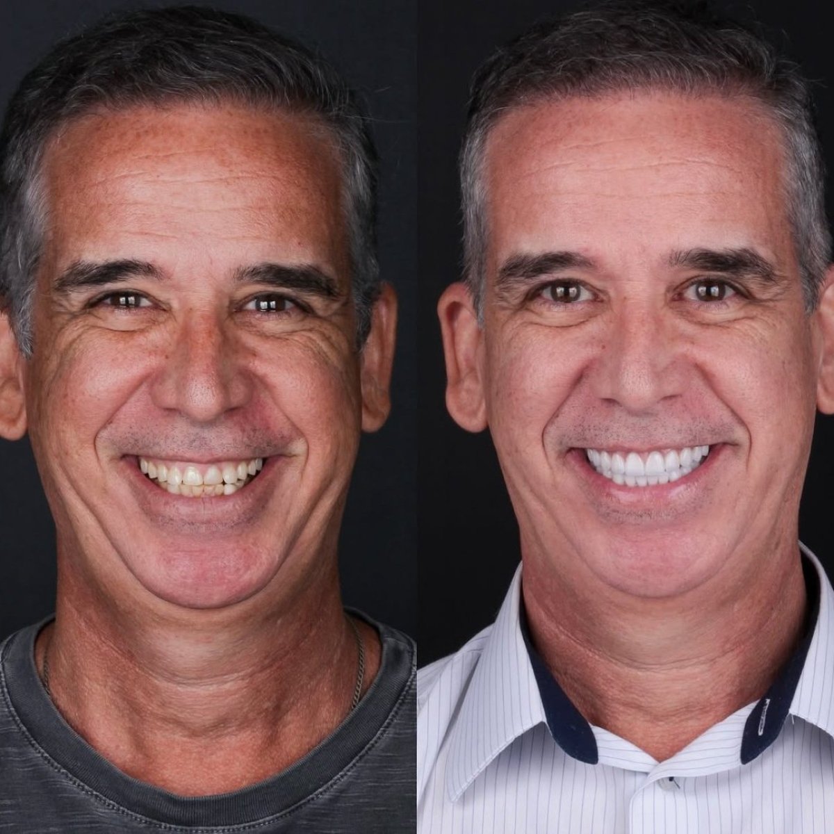 before and after photo