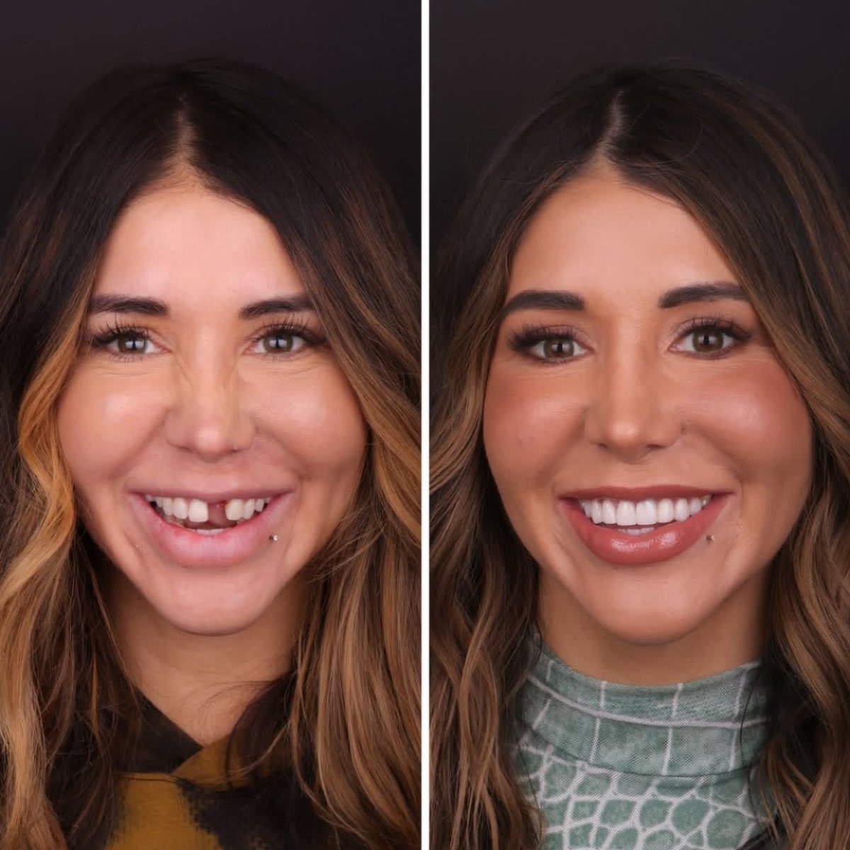 before and after photo