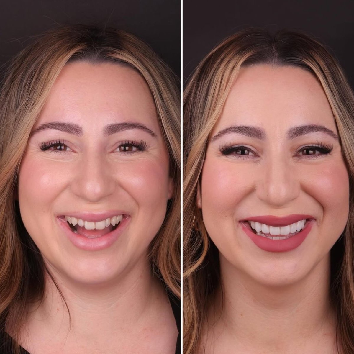 before and after photo