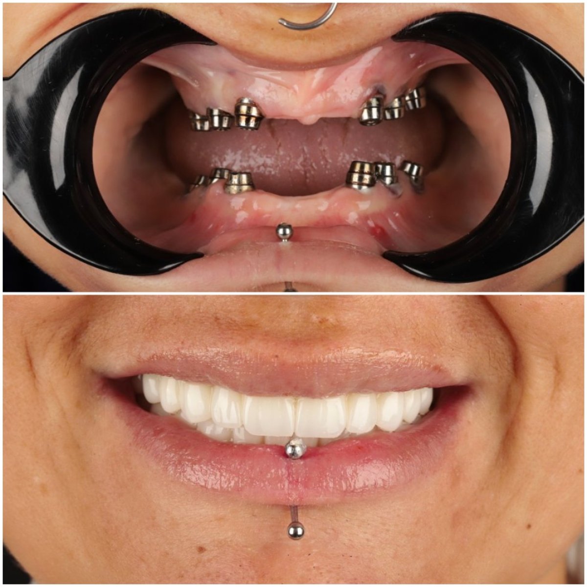 before and after photo