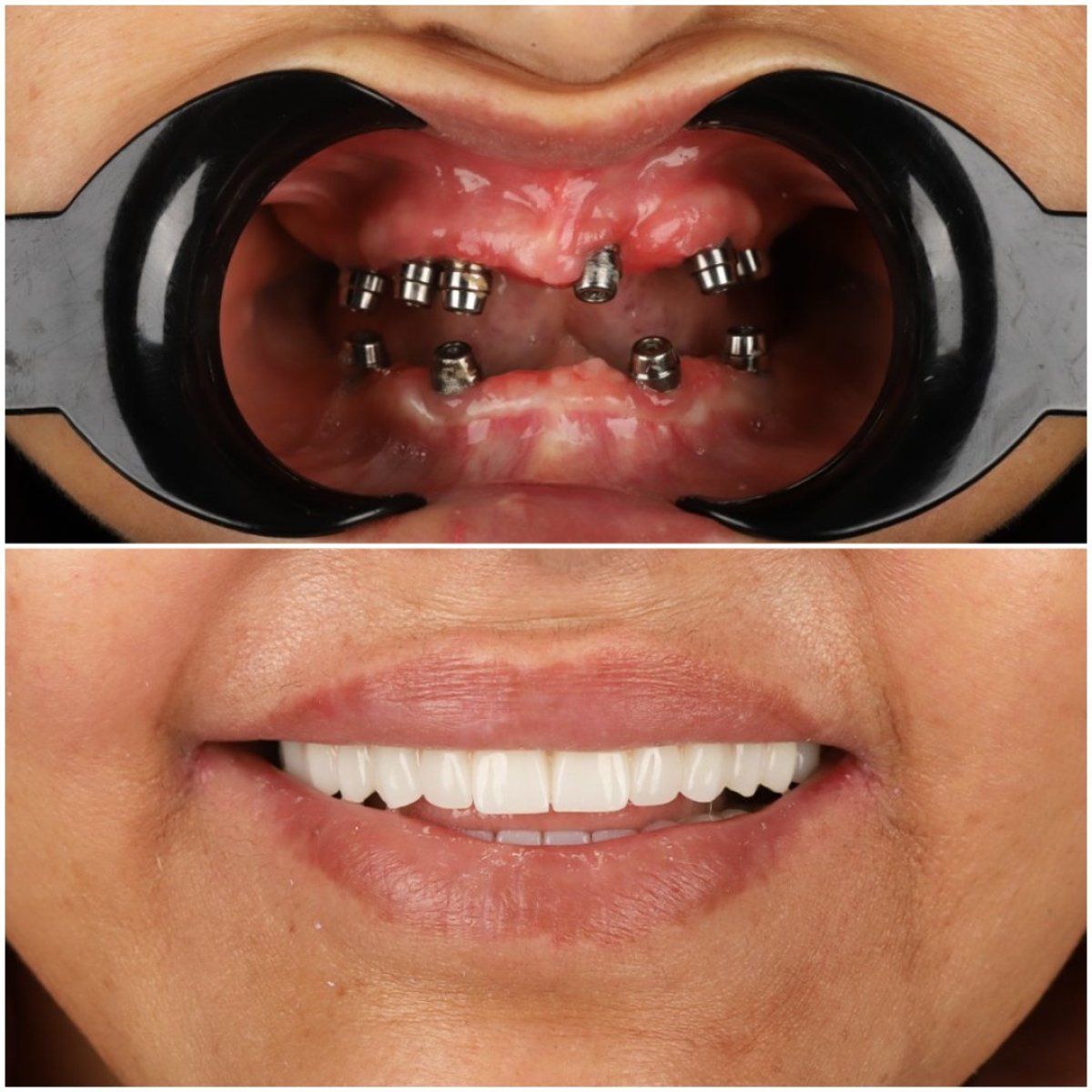 before and after photo
