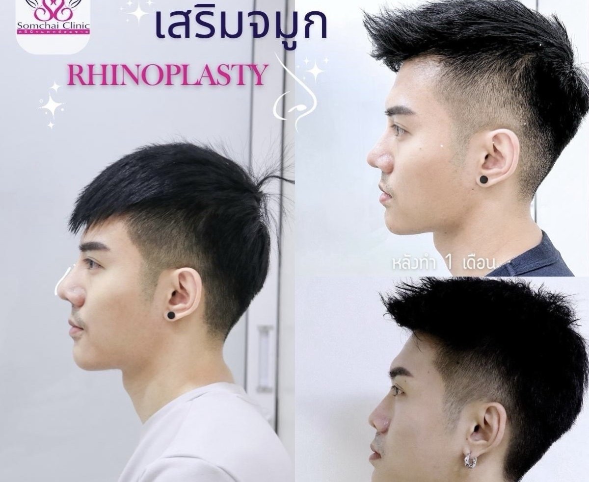 before and after photo