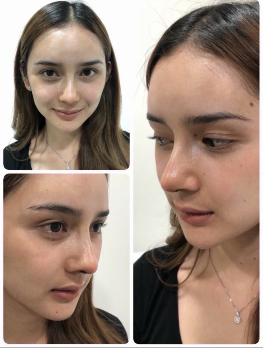 before and after photo