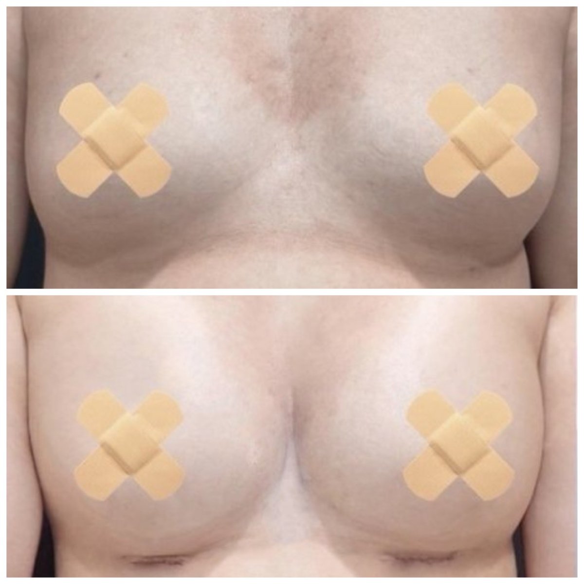 before and after photo