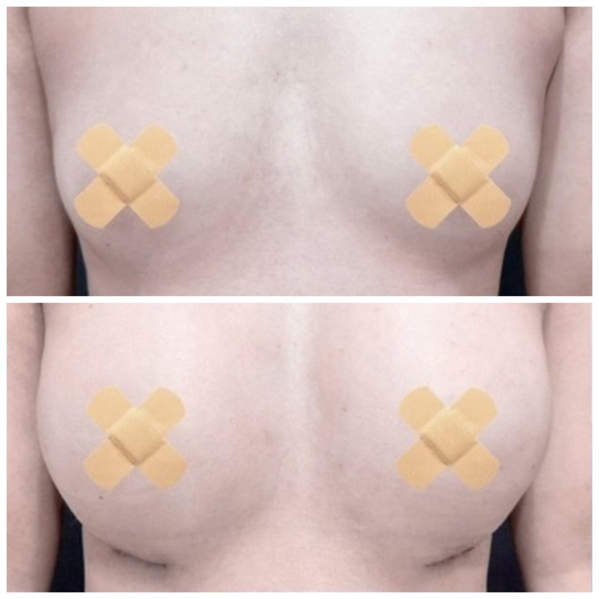before and after photo