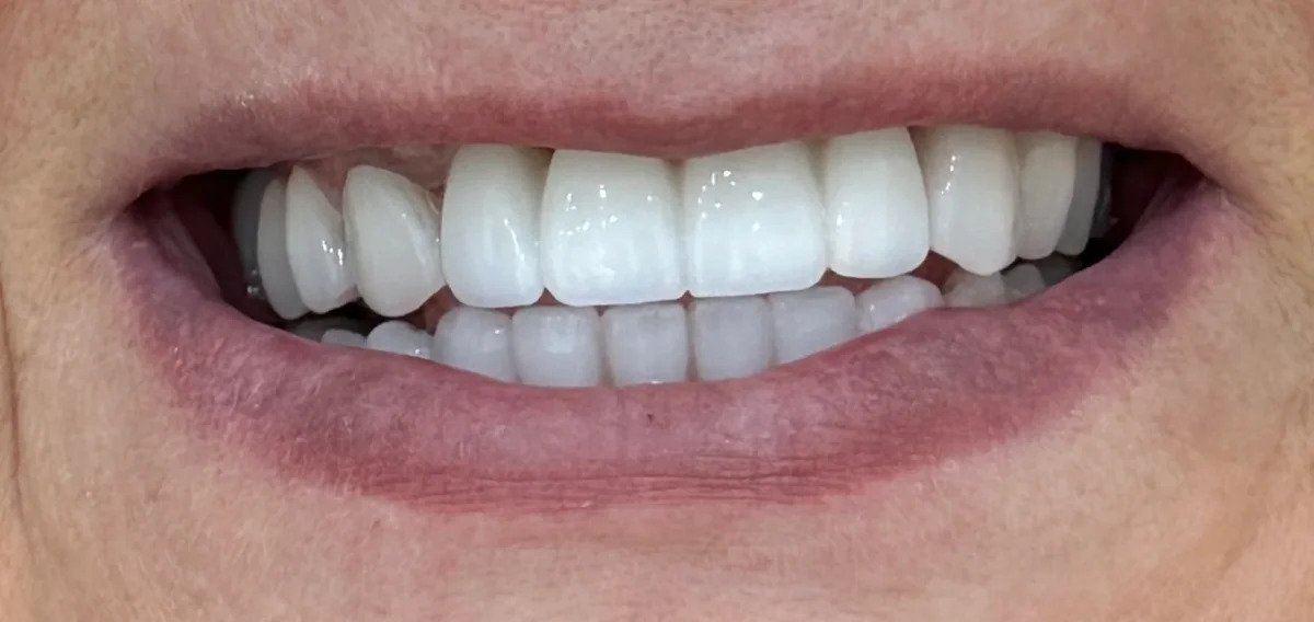 before and after photo