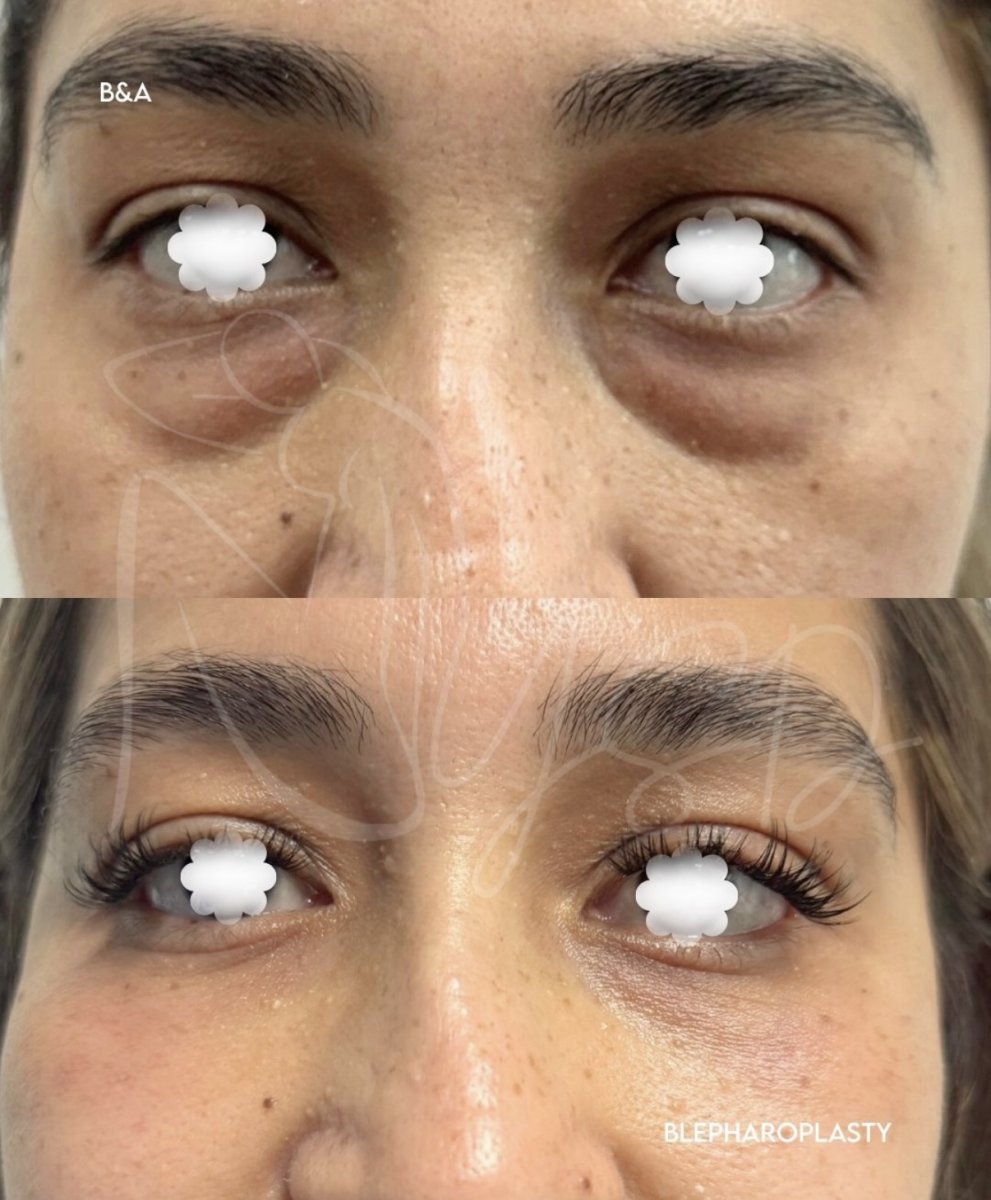 before and after photo
