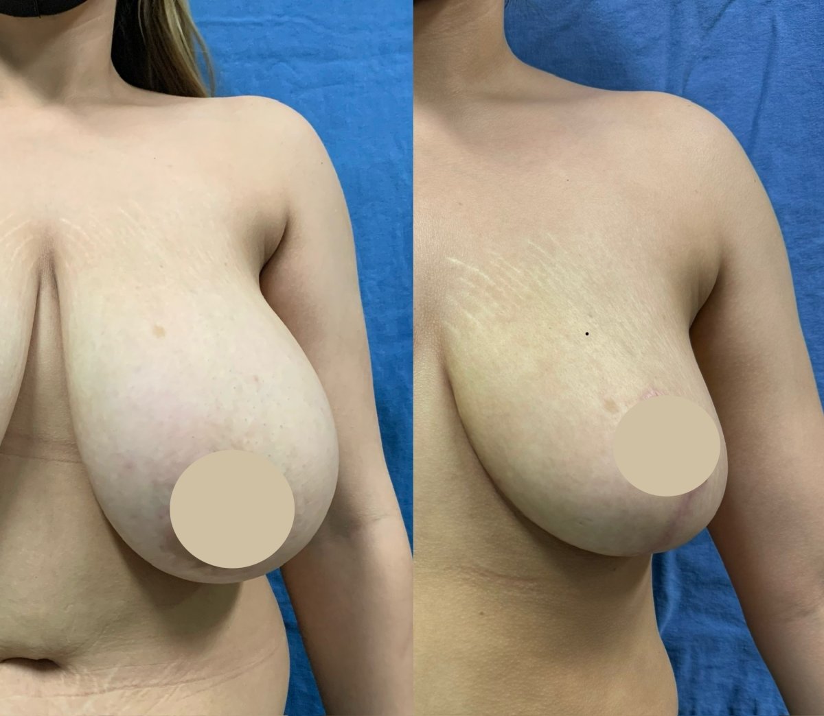 before and after photo