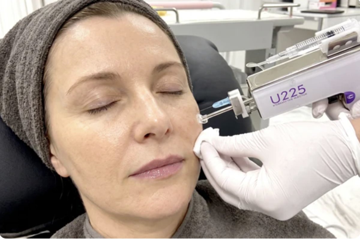 Stem cell rejuvenation therapy for anti-aging at Omotesando HELENE Clinic, facial treatment result