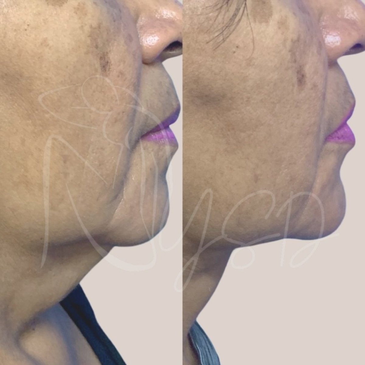 before and after photo